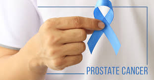 Prostate-cancer.jpg