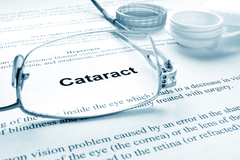 cataracts