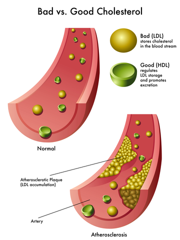 Control Cholesterol naturally without the aid of chemicals