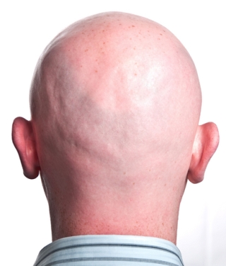 Losing your crowning glory?  Take a look at some natural Home Remedies for Hair Loss which are simple and easy  on your pocket