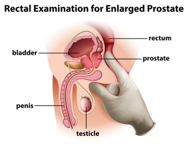 What on earth can I do to help with my prostate problems?