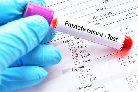 prostate cancer blood test